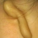 더원보청기 이미지