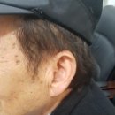 목동독일보청기 이미지