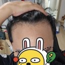 모디헤어플란트의원 이미지