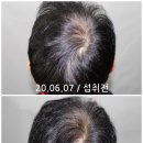 동명 남성 헤어 네이버블로그