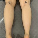 피부맑음 에스테틱 이미지