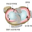 연령별 무릎통증 40~50대 무릎 이미지