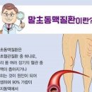 걸을 때 다리 저림 통증 원인 이미지