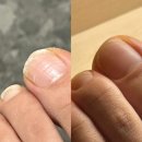 하남 망월동 네일샵 : 친근하고 꼼꼼한 문제성 발톱 케어 전문점, 한센스네일