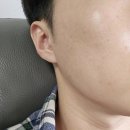 Gwell헤어 | 강남역피부과 리프팅잘하는곳 강남 튠페이스 후기