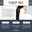 오십견의 원인과 비수술적 치료 이미지