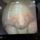 신오범이비인후과 Daum카페