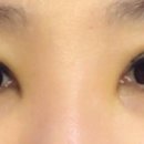 은삼성성형외과 이미지