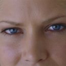 주름성형 전문 클리닉엔의 안면거상술과 엔도타인이마거상술 이미지