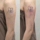 세상에서 제일 쉬운 신개념 중국어 고급 | 압구정 웨딩관리 꽁쌤에스테틱 뼈말라 팔뚝 솔직 후기 ｜1회 만에 변화 느낀 리뷰