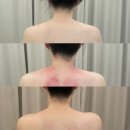 에뚜알 | 문정동피부관리-에뚜알에스테틱 물톡스, 바디 관리 후기 (내돈내산 포함 후기)