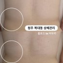 한산일주로가로수 | 청주 체형관리샵 추천 | 휠로스 in 미우키 상체후면관리 후기