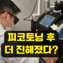 광원프라자 | 분당기미잡티, 피코토닝 받았는데 왜 더 진해졌을까