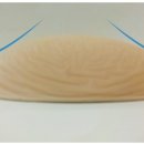 이브메디칼대구 네이버블로그
