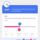 부산 [ 강화 프로 스마일라식 ] 쫄보의 수술 후기