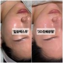 힐링에스투 | 사천에스테틱 산후관리 「힐링에스투」에서 출산 후 무너진 피부장벽 회복하기!