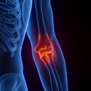 분당삼성정형외과의원 이미지