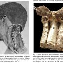 Occipital neuralgia(두부 신경통)... 정리중... 이미지