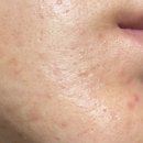 이소약국 이미지