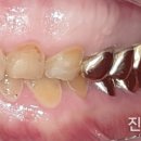 상아플란트치과 이미지