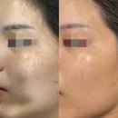 멜라 뷰티 이미지