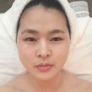 4191 | 홍대신지윤피부관리 비대칭 윤곽관리,연예인 소문난 홍대윤곽관리 맛집 후기