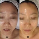 떡뜰날 | 군산피부관리실/군산피부샵)))기미잡티없애는법 : 효과보고 자신있게 공유하는후기~