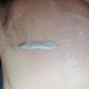 소사탕후루 | 스킨플래닝 뜻과 부작용 소사피부관리 뷰티새로움에서 받은 솔직후기