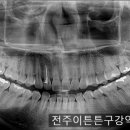 이튼튼구강악안면외과치과의원 네이버블로그