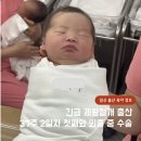 11260-2-37-4 | 제왕절개 37주 출산 응급제왕 입원기간 후기 통증