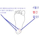 병상일기02 (그동안의 정리. 살짝 스압) 이미지