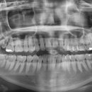 능치과의원 이미지