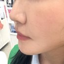 EGF마스크팩 추천 세르망화장품 리프팅팩으로 동안피부 관리한 후기