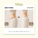 행복약국 | 결혼 후 다이어트 행복한약국 캡슐한약 4kg 감량 후기