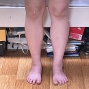 대원약국 | 뉴베인 가격 내돈내산 약국 다리 붓기빼는약 후기
