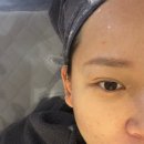 자이화장품 | 부산 동래역 피부관리 올가드림뷰티 명륜자이점 문제성피부 여드름 관리 후기