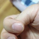 옹골슈퍼 | 약한손톱의 구원자.셀리피트 라운드 메이커(올인원 네일케어)