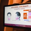 강남 남자 수염자국 제모 후기 유스타일나인