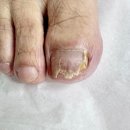 비전5로 | 평택발관리 푸스케어 평택비전점 평택내성발톱 평택무좀 관리 추천