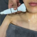 수연휴게점 | [대구 동구 경락]얼굴 작아졌다는 말 듣고 싶다면? 수연테라피 리프팅 후기