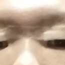 이학수성형외과의원 | 이학수 성형 외과 의원 쌍꺼풀 후기