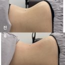 약봉테라피(마사지 교정운동) | [경기/고양시] 삼송마사지 지축마사지 바로테라피 원흥점 후기 💪