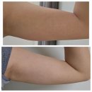 블루밍의원 이미지