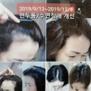 스무살에머물다 | 시흥 은행동 스무살에 머물다, 두피스케일링 후기