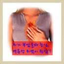 담즙 역류성 위염의발생 원인과 치료 방법 이미지