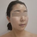 가온나무 | 울산윤곽관리 가온에스테틱 수기윤곽관리 후기