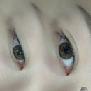 해운대 아이라인 제거 및 수정, 문제성 아이라인 해결을 위해 다들 사이렌을 찾는 이유