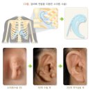 Q53.9 상세불명의 미하강고환 Undescended testicle, unspecified 이미지