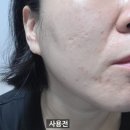 알리아 | [체험단] 슈알리아 SHC-100 뉴트리션 앰플 사용후기
