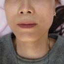 나누면 | 신논현피부과 고민해결 만족스러운 온다리프팅 후기